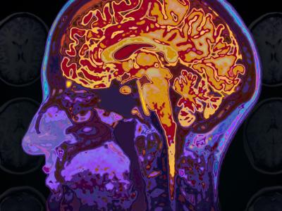 Skanningsbillede af en hjerne