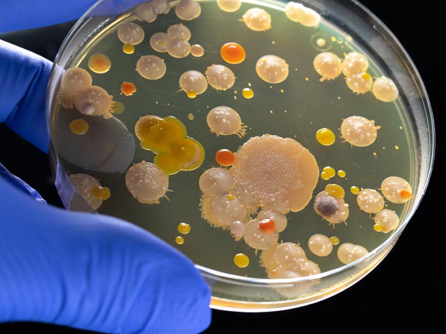 Petriskål med bakterier